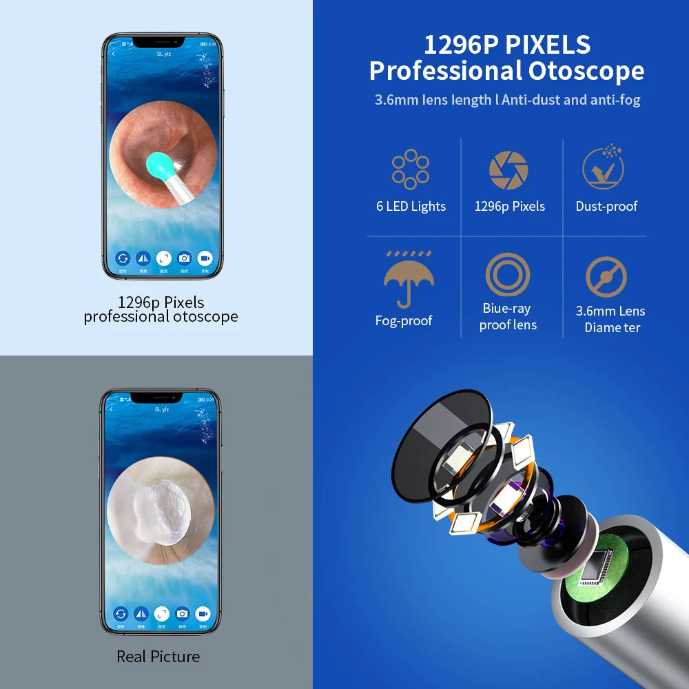 NE3 Wireless Ear Cleaner Camera - LED Otoscope Cleaning Kit